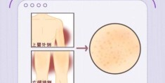 快速理解鹤骨鸡肤的意思，原来这么简单！