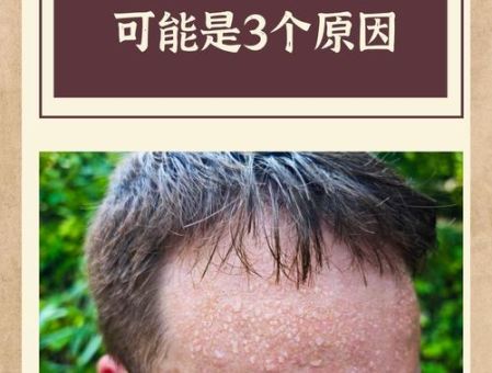 人形汗印是什么意思为什么会出现这种现象