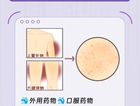 快速理解鹤骨鸡肤的意思,原来这么简单!
